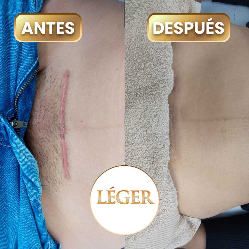 andes-despue-leger-1